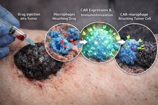 종양 속 잠든 면역세포로 '암' 직접 공격…"동물모델서 치료효과 확인"