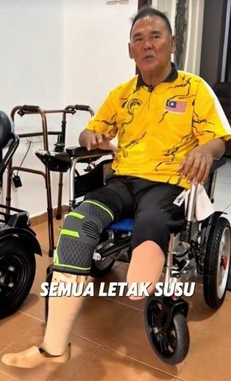 "탄산음료에 '이것' 한 스푼…결국 두 다리 절단했다" 사연 보니