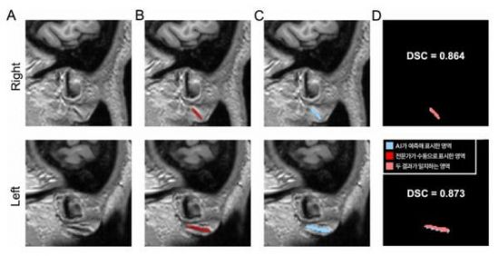 "단순 노화인줄 알았는데" 귓불 주름 '이곳' 손상 신호?
