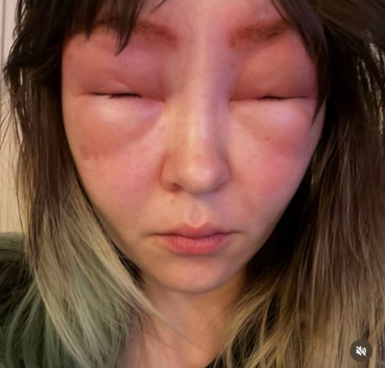 눈썹 염색 했을 뿐인데…"외계인 됐다" 왜?