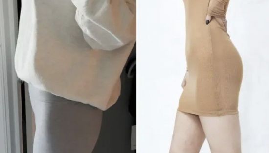 6600만원짜리 요즘 유행하는 '기괴한 성형'…"시신 지방으로 볼륨 빵빵하게"