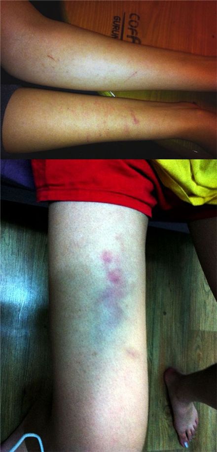 [단독][이상구 폭행논란]피해여성 3명 직격 인터뷰 "무참히 폭행당했다"