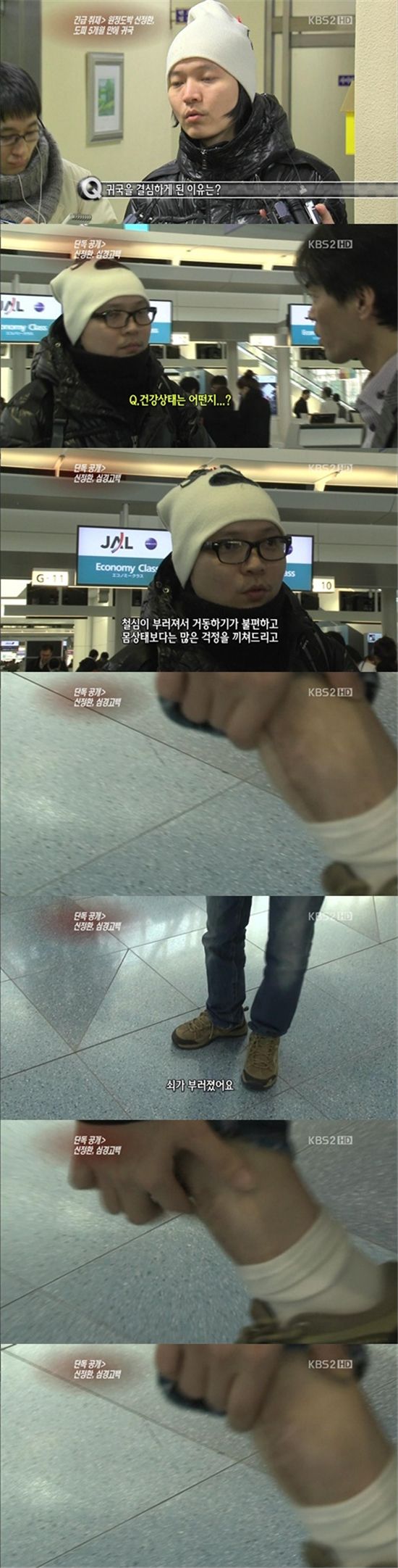 신정환, 철심 부러져 뼈 어긋난 심각한 다리 상태 공개