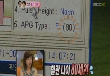 박소현 혈관나이 '충격'…"동안인데 혈관은 80세"