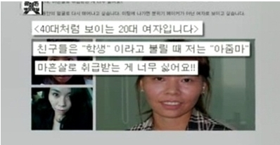 노안녀 결국 성형 결심, 그 속사정 알고보니