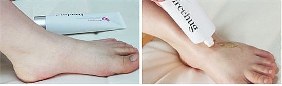 초가을 아토피 관리 1계명 “건조함, 스트레스 피하라”