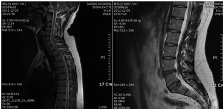 ▲ 무소속 강용석 의원이 주신씨가 병무청에 제출한 MRI 사진이라고 공개한 필름 