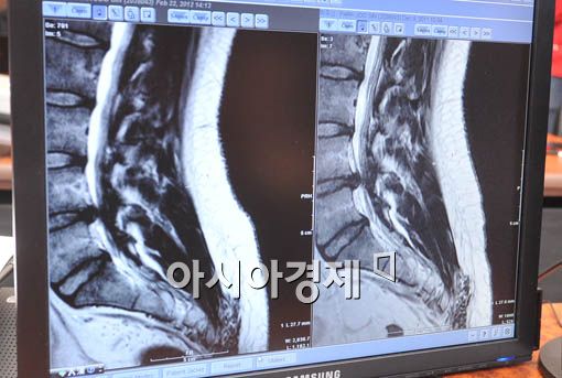 [포토] 디스크로 판명난 박주신씨의 MRI 