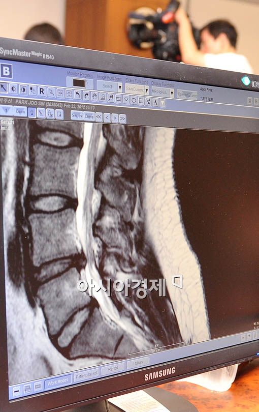 [포토] 언론에 공개된 박주신 MRI 사진 