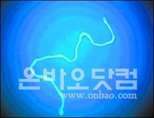 ▲ 남방의과대학 주장병원에서 샤오페이 양의 뇌를 검사했을 당시 발견된 기생충의 모습(출처: 온바오닷컴)