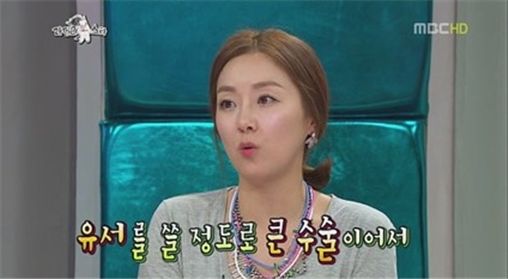 김지혜 양악수술 경고 (출처: MBC '황금어장-라디오스타')