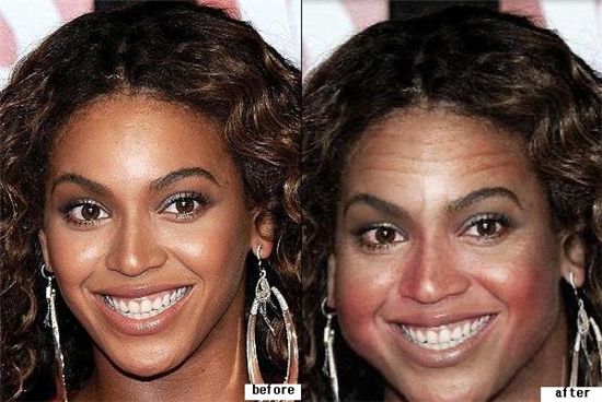 매일 술 마시는 당신, 깜짝 놀랄만한 사진