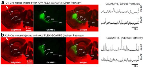 파킨슨병 등 뇌질환 원인, 치료법 새 방향성 찾았다