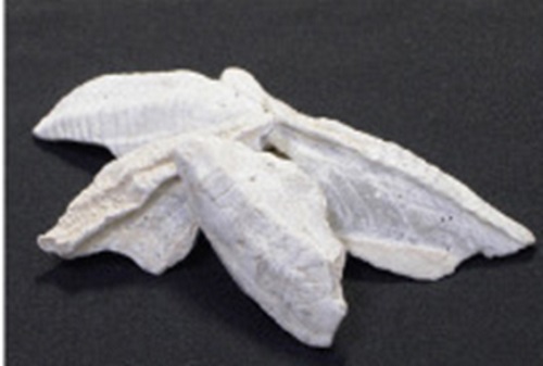 한국인의 칼슘섭취 부족, 내 몸에는 어떤 일이? 