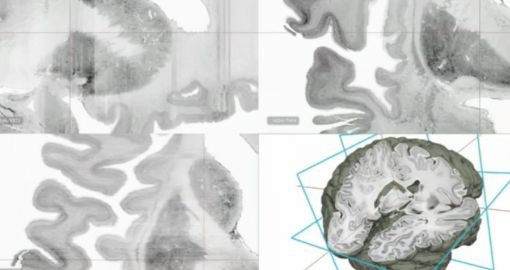 3D 뇌 지도 "800억개 신경세포 총망라"
