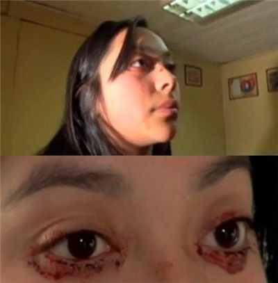 ▲ 붉은 눈물 흘리는 여성(출처: 온라인 커뮤니티)