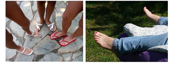 여름철 여성 발건강 지키려면 "편한신발·자외선 차단제" 
