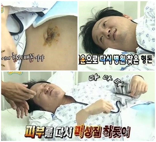 정형돈 수술 묘사 화제, "창자 밀어 피부 미싱질" 깜짝