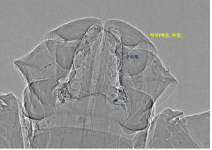 '살인진드기'도 촬영한 고성능 빔라인 "질병연구에 기여"