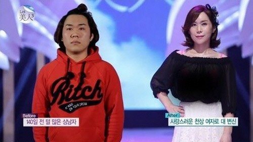 '렛미인' 김미영, '털 많은 여자'에서 천상여자로 완벽 변신