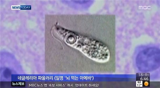 뇌먹는 아메바…'걸리면 죽는다, 치사율 99%'