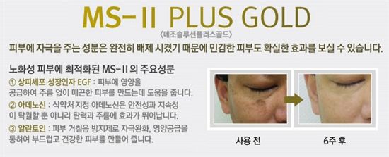 탤런트"김미숙" 동안피부 비결 무엇인가 했더니… 