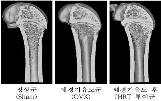 한약제재로 골다공증 치료 새 길 열었다