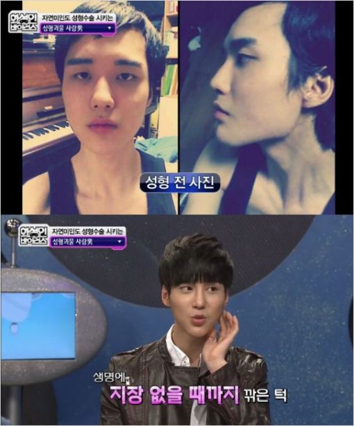 화성인 성형중독남, 50번이나 성형한 얼굴 "심했다!"