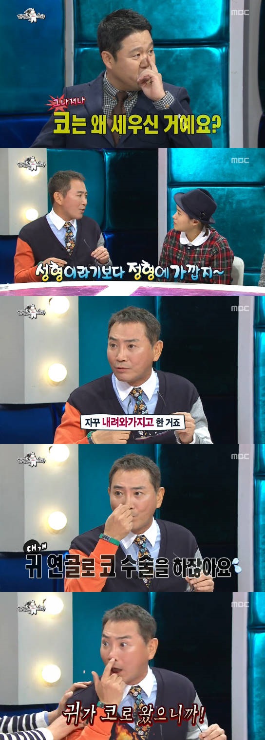 '라스' 이봉원 "안경 내려와서 코 성형수술…끝은 진짜"