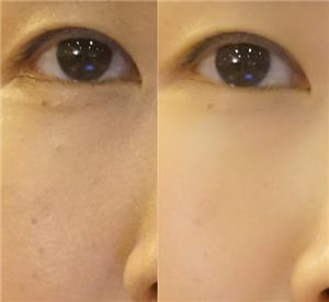 소프트 스킨을 적용하지 않은 얼굴(왼쪽)과 소프트 스킨을 적용한 후의 얼굴사진. 