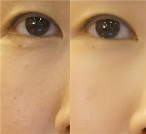 소프트 스킨을 적용하지 않은 얼굴(왼쪽)과 소프트 스킨을 적용한 후의 얼굴사진.