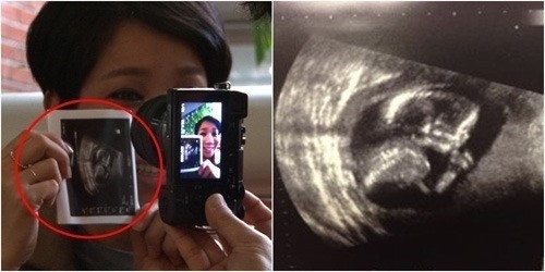 김송 임신, 결혼 10년만의 아기…"정말 감사하다"