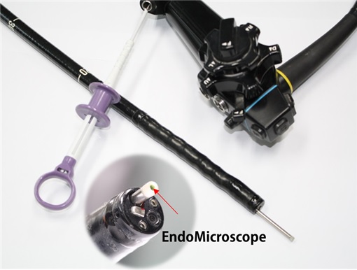 실시간 조직검사 현미경 개발…정확한 시술 가능