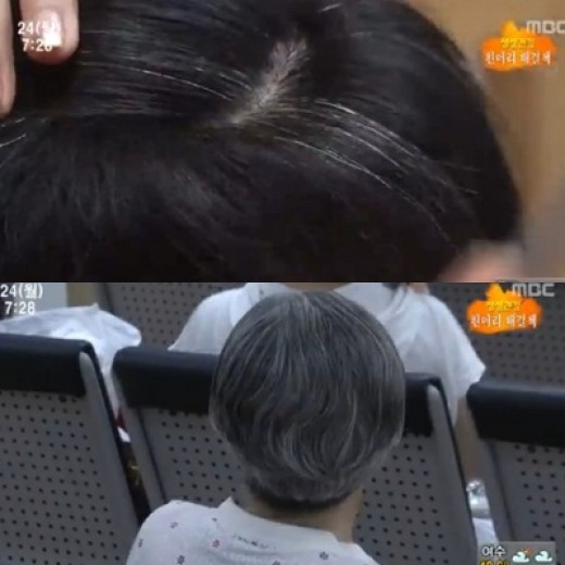 ▲흰머리 생기는 원인(사진 출처:MBC방송캡처)
