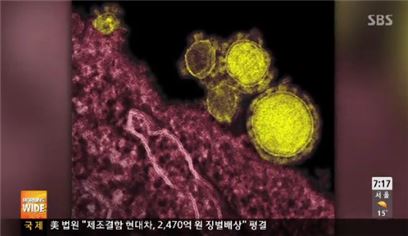 메르스 바이러스 진단키트 개발…15분 만에 감염 여부 확인 