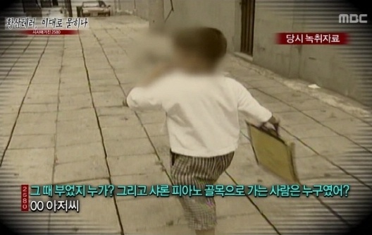 ▲대구 어린이 황산 테러.(사진:MBC '시사매거진2080' 방송 캡처)