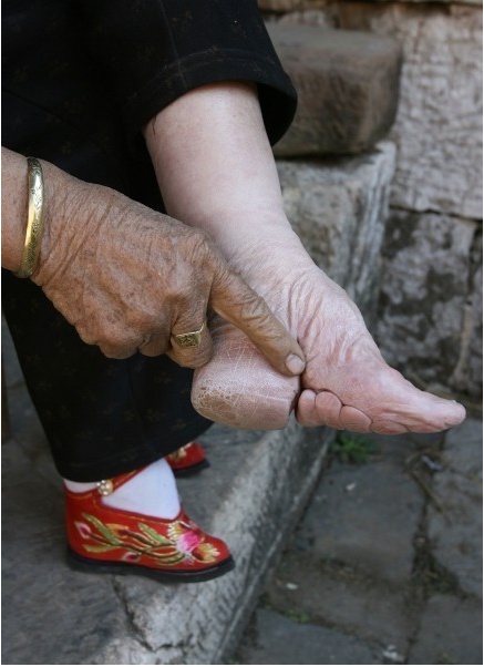 ▲전족 풍습을 가지고 있는 중국 여성의 발(사진:EBS 제공)
