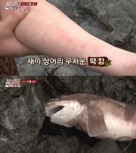 ▲유상무가 상어에 물려 화제다.(사진:tvN '시간탐험대' 방송캡처)
