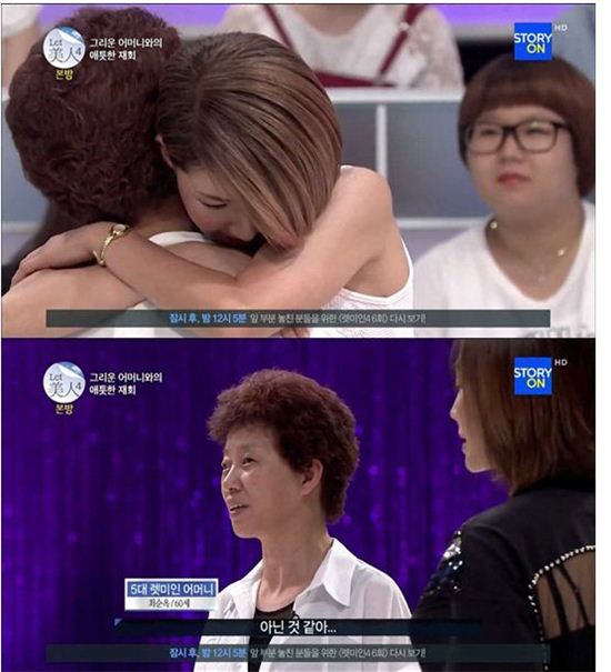 '렛미인4' 윤단비 "성형 수술 후 엄마도 못 알아봐"