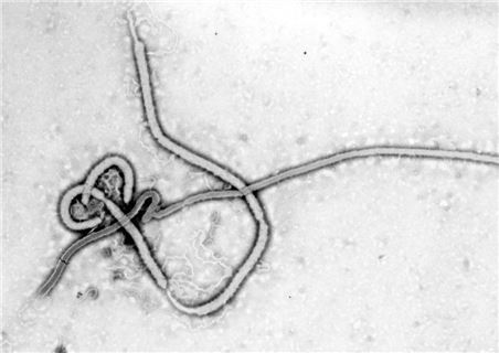 에볼라 바이러스(사진: 위키피디아 제공)
