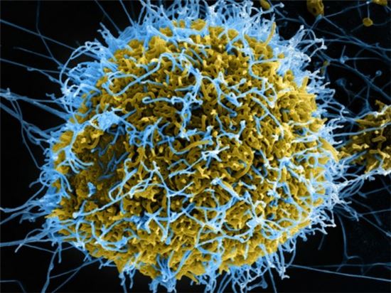 ▲원숭이 신장세포(노란색)를 파괴하고 있는 에볼라 바이러스(파란색).[사진제공=사이언스/NIAID]