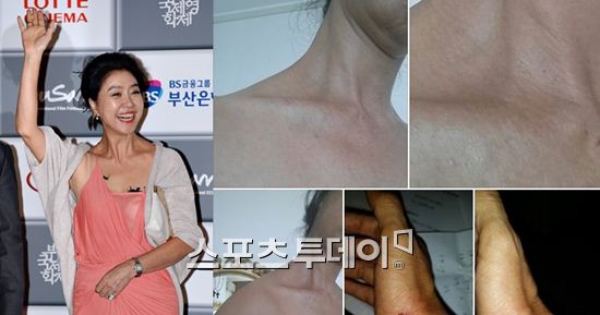배우 김부선이 주민들로부터 먼저 폭행을 당했다고 주장했다.[사진=김부선 페이스북]