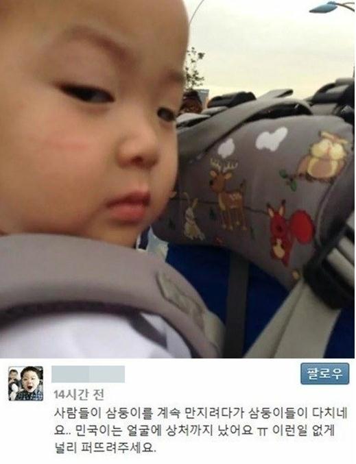 송일국 해명, 민국이 얼굴 상처 "자다가 긁은 것"