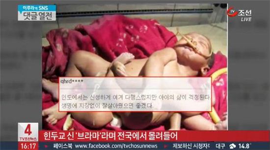 팔다리 8개 아기…"신의 재림" VS "지구 종말의 징조" 공방 벌어져