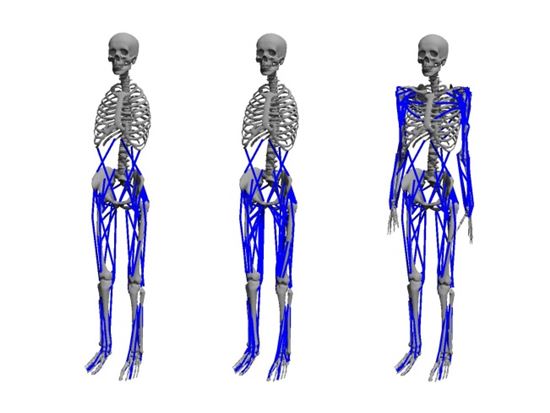 가상 근육 모델로 근골격 수술결과 예측한다