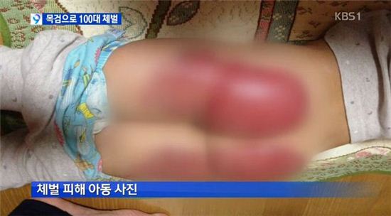 6세 어린이 목검 체벌 /사진=KBS 뉴스 캡쳐