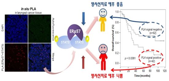 ▲후두암 세포의 방사선 치료 내성의 원인이 규명됐다.[사진제공=미래부]