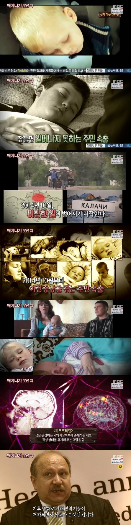 수면병 / 사진= MBC '서프라이즈' 방송 캡쳐