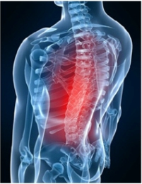 척추 수술…정형외과 의료소송 중 22% 차지