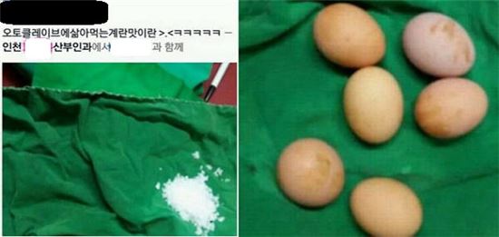 수술용 소독포 위에 삶은 계란과 소금이 올려져 있다.  /사진=온라인 커뮤니티 캡쳐 